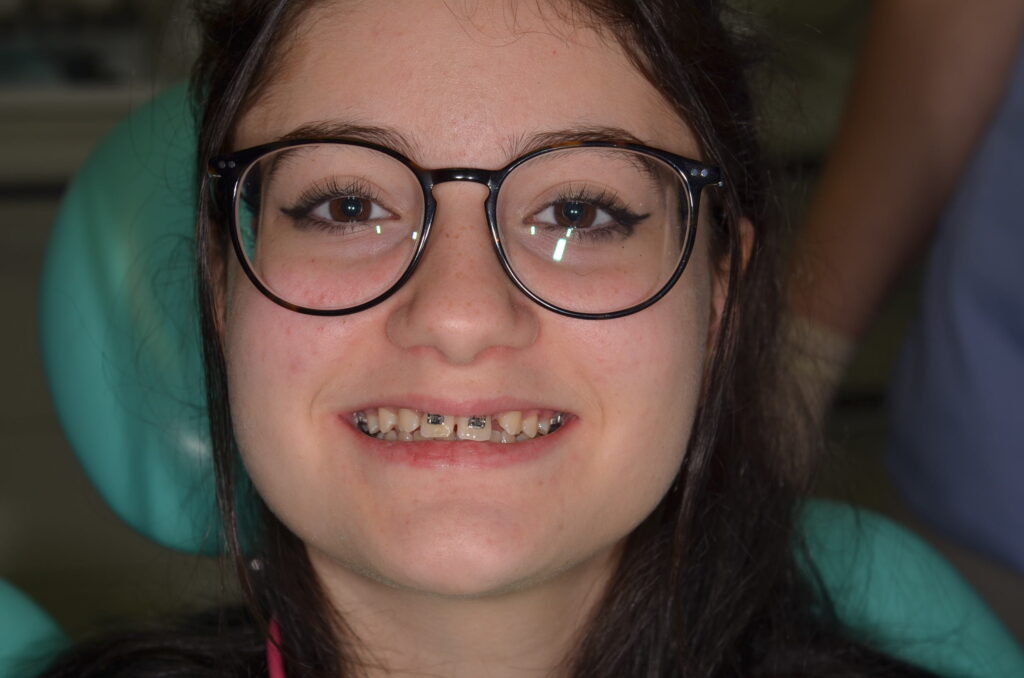 Lotartaro_Elisabetta